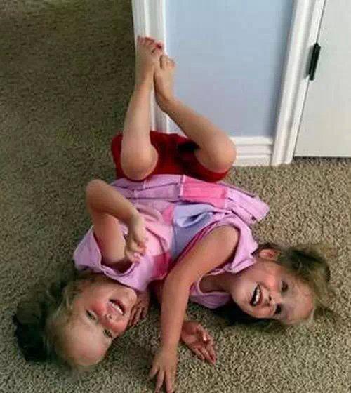 全球奇特的连体人!你一定没见过! 全球奇特的连体人!你一定没见过!