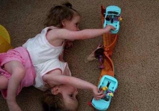 全球奇特的连体人!你一定没见过! 全球奇特的连体人!你一定没见过!