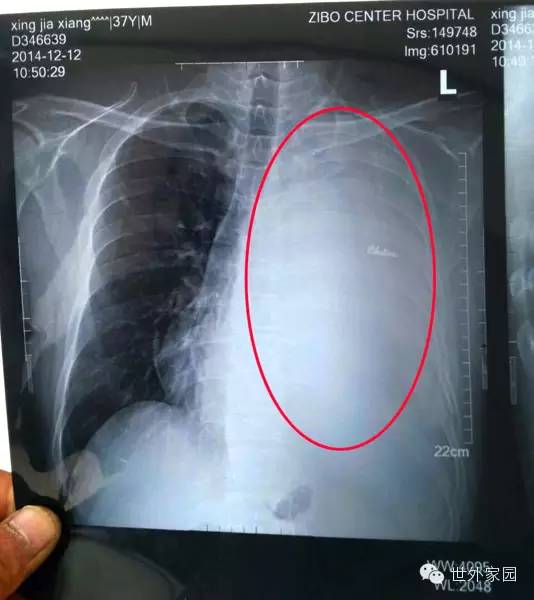 �漣������£��ӷΰ����ڵ�����Ȭ��