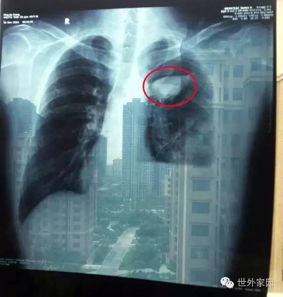 �漣������£��ӷΰ����ڵ�����Ȭ��