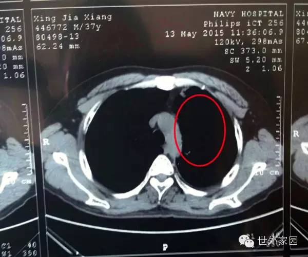 �漣������£��ӷΰ����ڵ�����Ȭ��