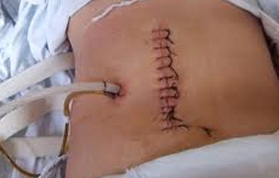 震惊:肉食背后的25个真相 震惊:肉食背后的25个真相