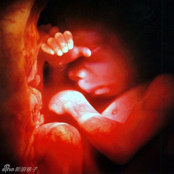 婴儿一入胎就已经有生命,3000年前的佛陀的话正在被科学验证 婴儿一入胎就已经有生命,3000年前的佛陀的话正在被科学验证